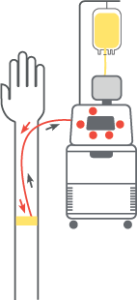 Apheresis Platelets Diagram