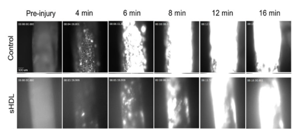 FeCl3-induced carotid artery thrombosis model