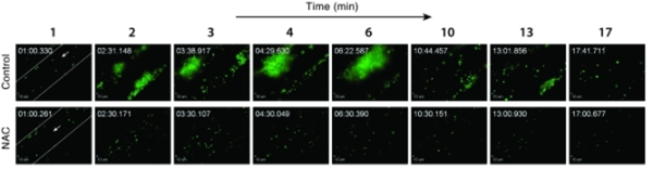 VWF-mediated microvascular thrombosis model