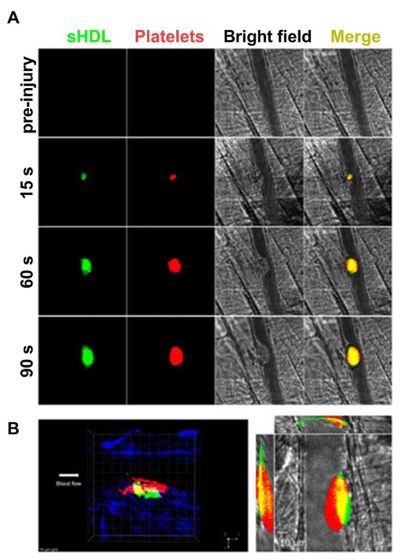 Laser-induced cremaster arteriole thrombosis model